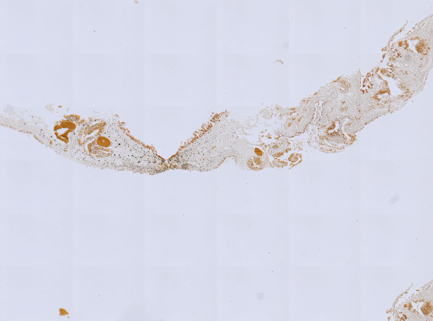 Mikroskopisches Bild einer Formalin/PFA-fixierten Paraffin-embedded Gewebeschnitt, der mit anti-PFA1-Antikörper (EPR22828) und BSA angefärbt wurde.